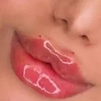 آفر۷۰%ژل بوتاکس لیفت‌/نخ مزوژل/فیلربینی شقیقه/پزشک