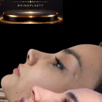 جراحی های زیبایی بینی،گوش،لیفت ابرو و شقیقه