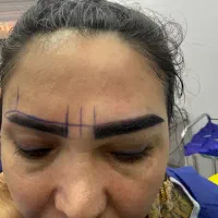 کاشت مو ‌ابرو خدمات زیبایی رینو پلاستی لیپو ابدو