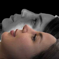 جراحی بینی فقط با ۴۰میلیون تومان توسط متخصص