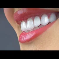 دندانپزشکی و خدمات کامپوزیت و زیبایی