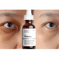 درمان سیاهی زیر چشم سرم Ordinary اصل