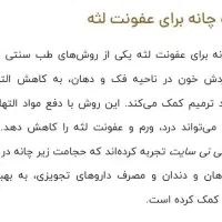 حجامت|خدمات آرایشگری و زیبایی|عسلویه, |دیوار