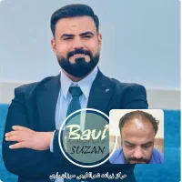 تخفیف تابستانه کاشت موی سر و ابرو و ریش