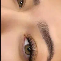 کاشت مژه یک ماهه