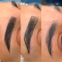 فیبروز ابرو فقط هزینه مواد