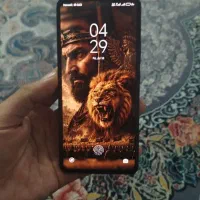 شیاومی نوت ۱۳ / note 13