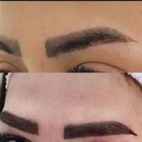 کاشت ابرو طبیعی