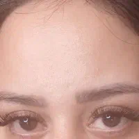 کاشت مژه دائم