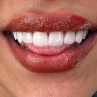 دندانپزشکی اقساطی