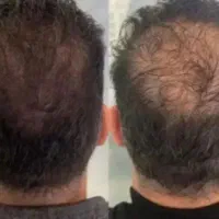 از افسردگی نجاتت میدم