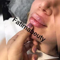 فیلر و بوتاکس مزو تراپی