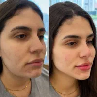 بهترین کلینیک زیبایی تهران (شهرک غرب)