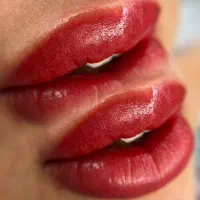 فیبروز،میکروبلیدینگ تخفیف ۲۰ درصدی به مدت محدود