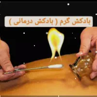 حجامت بادکش درمانی