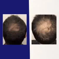 پایان ریزش و آغاز رویش