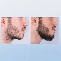 معجزه|آرایشی، بهداشتی، درمانی|خورموج, |دیوار