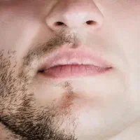 لیزر تخصصی اقایان