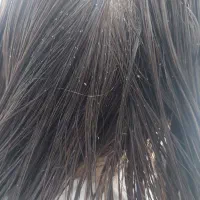 پاکسازی کامل رشک و شپش تضمینی در شهرک شهید رجایی