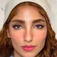 تنهامرکزبلفاروپلاستی لیزری مشهدبادستگاه/ابدو/ساکشن