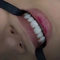 دندانپزشکی کامپوزیت لب شیشه ای ایمپلنت دیجیتال