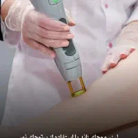 (مرکز تخصصی لیزر کندلا 2025) /بدون ژل/خانم واقایان