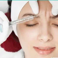 جشنواره تزریق بوتاکس و فیلر