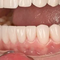دندانپزشکی تخصصی با ضامنت /اقساطی/وام پزشکی تبریز