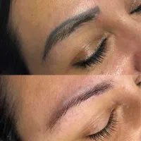 پاک کردن تتو صورت وبدن لیزر کیوسوئیچ