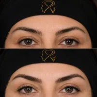 مدل جراحی زیبایی