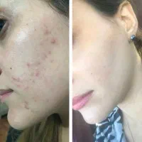 کرم بیوممتیک  اصل ایتالیایی