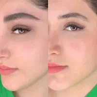 تنها مرکز تخصصی میکرو کرکی ومویی