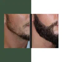 ریشتو دست کم نگیر