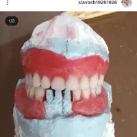 ساخت دندان متحرک