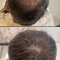 پوستی شفاف داشته باشین