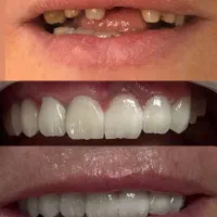 ویزیت رایگان کلینیک دندانپزشکی نیمه دولتی سیب