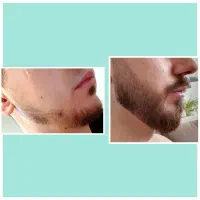 پرپشتی رو با این تجربه کن