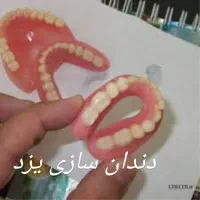 دندان مصنوعی کامل و تیکه