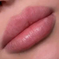 فیلر ،بوتاکس، میکرو ابرو