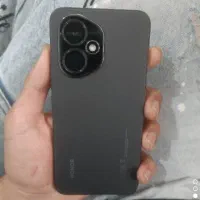 گوشی آنر 400 نسخه گلوبال