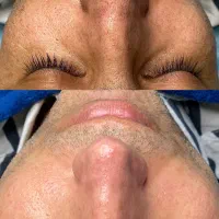 فیشال و پاکسازی پوست خانم و اقا