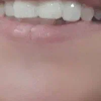دندان سازی و ترمیم دندون شازند