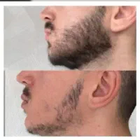 رشد و تقویت فقط توی ۴ هفته با این محلول