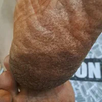 کفسابی تخصصی پا