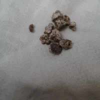 دمنوش رفع سنگ کلیه و جلوگیری از ساخت مجدد