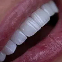 استخدام نیروی خانم کانتر و دستیار دندانپزشک
