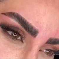 آموزش فیبروز ابرو