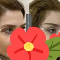 جراحی توسط پزشک متخصص وجراح زیبایی(کرمانشاه)