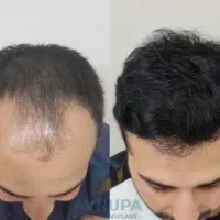 تغییر امروز نتیجه فردا