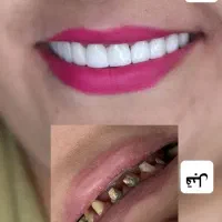 زیبایی|خدمات آرایشگری و زیبایی|خوی, |دیوار